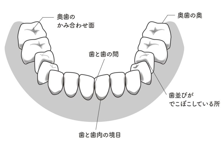 歯垢